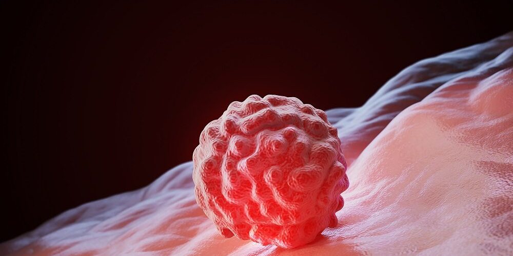 Quand s’accroche l’embryon après transfert1 Quand s'accroche l'embryon après transfert