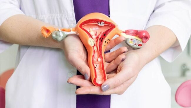 Peut-on tomber enceinte en ayant un kyste 2 Peut-on tomber enceinte en ayant un kyste?